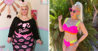 A Woman Lost 200lbs to Resemble Barbie, Just Like Her Parents Always Wanted