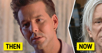 Mickey Rourke’s Tragic Face Journey That Nearly Destroyed Himself