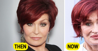 “I Think I Went Too Far,” Sharon Osbourne (72) Finally Reveals the Truth About Her Transformation