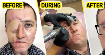 A Tattoo Artist Creates a New Eye for a Man After He Loses It in a Car Accident