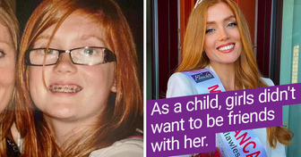 A Lady Who Faced Hardships for Her Ginger Locks Has Become the First Redhead to Be Crowned Miss England