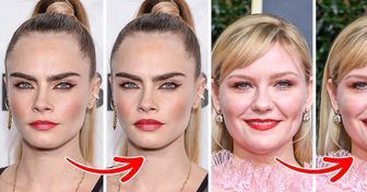 What 15+ Celebrities Would Look Like If They Did One of the Most Popular Beauty Procedures