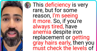 “It’s Not Only About Genetics,” Doctor Explains What Thing You Might Be Deficient In If You Get Gray Hairs Young