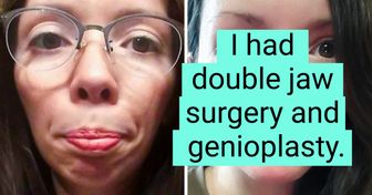 19 People Who Weren’t Afraid to Change Their Appearance and Became Even More Beautiful