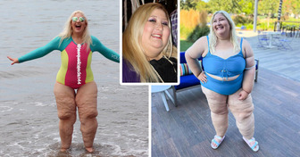 A Woman Was Shamed for Her Loose Skin, and Here’s Her Inspiring Response