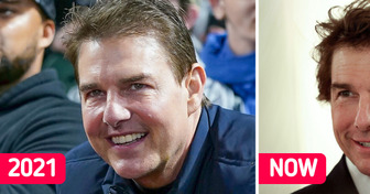 Tom Cruise Deemed Unrecognizable in New Pics With Prince William, as Some Say He Had “Too Much Surgery”
