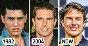 10 Legendary Celebs Whose Look Has Changed Drastically From Decades Ago