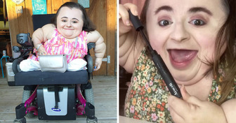 A Girl With a Rare Disease Became a Beauty Influencer and Proved to the World What People With Disabilities Are Capable of