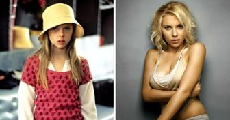 20 Celebrities Before They Became Famous