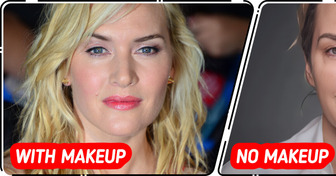 10+Celebrities, Who Totally Rock Their 'No-Makeup, No Filters' Look