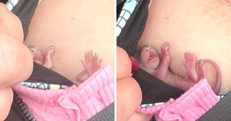 A Woman Rescued an Abandoned Baby Animal and Its Delicate State Left Everyone Stunned