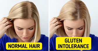 11 Unusual Signs You Might Have Gluten Intolerance