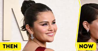 "She Got Filler and a Jaw Implant," Selena Gomez’s New Look Sparks Fan Speculation