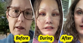 Woman, 50, Reveals Major Plastic Surgery Results That Make Her Look Decades Younger
