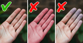 12 Secrets Your Hands Might Be Telling You About Your Health