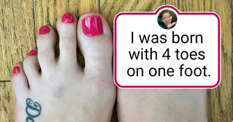 15+ People With Absolutely Unique Physical Features