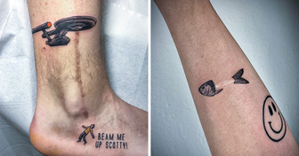 14 Times People Covered Up Their Scars With Glorious Tattoos