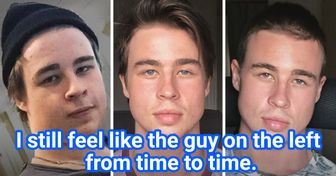 20 People Who Woke Up as a Different Person One Day