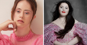 Besides Sofia Jirau, These 13 Models Broke Decades-Long Stereotypes About People With Down Syndrome