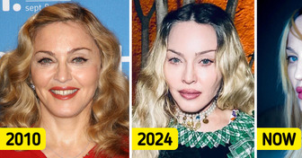 “This Isn't Her” Madonna Defies Age in Provocative Photos at 66—Looks Unrecognizable