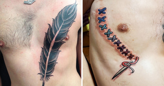 15 People Who Managed to Turn Their Scars Into Creative Works of Art