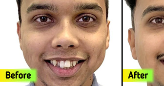 10+ People Who Took the Leap to a Beautiful Smile, and Never Regretted It