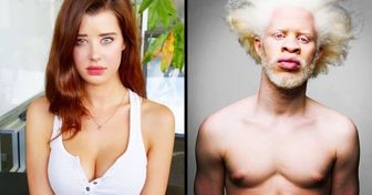 13 Models Whose Non-Standard Beauty Inspires Millions of People That Are Afraid to Be Themselves