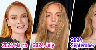 ‘That’s a Brand New Face’: Lindsay Lohan Keeps Shocking Fans With Her Changing Looks