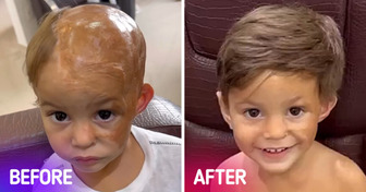 A Hairdresser Gives Free Hairpieces to Kids Who Lost Their Hair to Accident or Disease