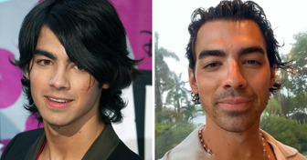 Joe Jonas Opens Up About Getting Cosmetic Procedures and He Has a Clever Goal in Mind