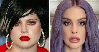 Kelly Osbourne Insists She Hasn’t Had Any Cosmetic Surgery and Here’s How She Explains It