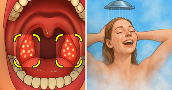 8 Hidden Causes of Psoriasis You Might Be Overlooking