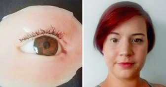 21 People Who Were Brave Enough to Show Their Unique Features to the World