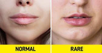 10 Body Features That Set You Apart From the Crowd