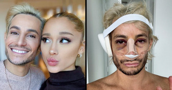 Ariana Grande Reveals True Feelings About Brother Frankie’s Nose Job