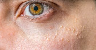 15 Tips on Improving Under-Eye Skin You’d Better Start Using Right Now
