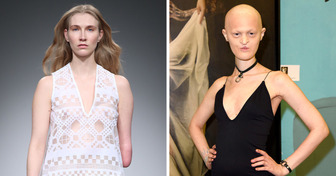 11 Models That Are Redefining the Fashion Industry