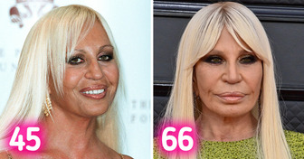 15 Celebrities Who Have Fully Reversed the Aging Process