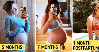 9 Celebrity Moms Who Were Proud to Show Their Postpartum Body to the World
