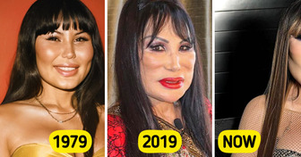 A Jealous Friend Ruined Mexican Star’s Beauty, Now She’s Reclaiming It