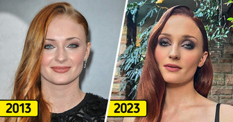 Amidst the Divorce Drama, People Are Asking: Has Sophie Turner Done Something to Her Face?