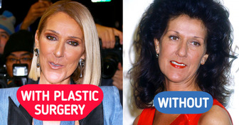 What 17 Stars Would Look Like Today Without Cosmetic Surgery