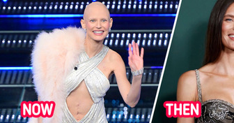 Victoria’s Secret Angel Sparks an Emotional Reaction Showing Her Shaved Head and Scar