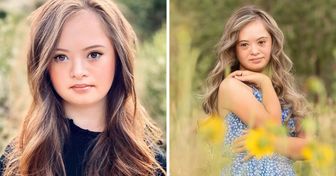 A Girl With Down Syndrome Beats Doctor’s Odds and Grows Into a Stunningly Beautiful Model