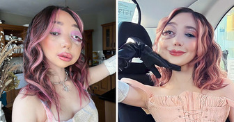 Despite Suffering From a Unique Facial Condition This Young Woman Uses Her Platform to Educate People