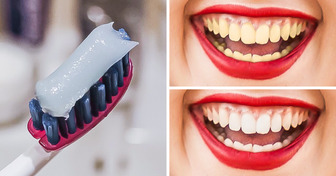 The 10 Best Ways to Naturally Whiten Yellow Teeth at Home