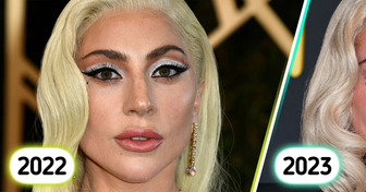 “She Needs to Leave Her Face Alone,” Lady Gaga’s Latest Appearance Sparks Controversy