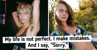 Cara Delevingne, Who Was Often Judged for Her Odd Behavior, Wants to Focus on Healing in Her 30s
