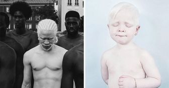 Photographers Capture the Unique Beauty of Albino People, and People Can’t Stop Loving Them
