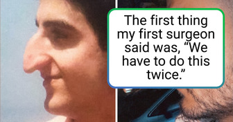 18 People Who Opted for Plastic Surgery to Change Their Look and Improve Their Self-Esteem